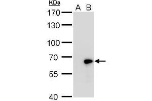 WB Image GAD67 antibody detects GAD67 protein by western blot analysis.