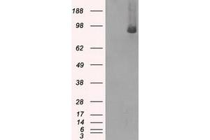 Western Blotting (WB) image for anti-B-Raf proto-oncogene, serine/threonine kinase (BRAF) antibody (ABIN1496953) (BRAF anticorps)