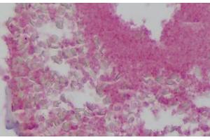 Human Colon: Formalin-Fixed, Paraffin-Embedded (FFPE)