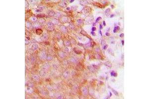 anti-Mitochondrial Ribosome Recycling Factor (MRRF) (C-Term) antibody