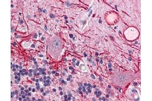 Immunohistochemistry (IHC) image for anti-V-Akt Murine Thymoma Viral Oncogene Homolog 1 (AKT1) (Thr308) antibody (ABIN400786) (AKT1 anticorps  (Thr308))