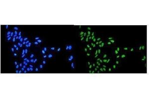 IF analysis of Topoisomerase I using anti-Topoisomerase I antibody (ABIN5692844).