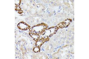 Immunohistochemistry of paraffin-embedded rat kidney using LTF antibody (ABIN6131498, ABIN6143382, ABIN6143383 and ABIN6216705) at dilution of 1:100 (40x lens).