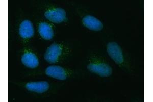 IF analysis of ZNRF3 using anti-ZNRF3 antibody (ABIN7602004). (ZNRF3 anticorps  (AA 54-913))