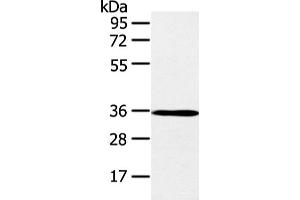 Western blot analysis of K562 cell and mouse brain tissue using E2F5 Polyclonal Antibody at dilution of 1:400