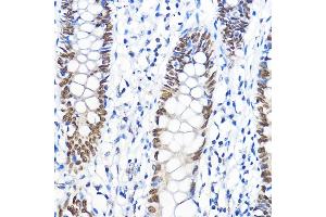 Immunohistochemistry of paraffin-embedded human colon using GTF2B Rabbit pAb (ABIN7267370) at dilution of 1:100 (40x lens). (GTF2B anticorps  (AA 50-150))