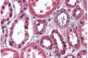 Human Kidney: Formalin-Fixed, Paraffin-Embedded (FFPE)