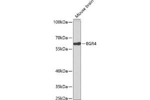 Western blot analysis of extracts of mouse brain, using EGR4 antibody (ABIN3016963, ABIN3016964, ABIN3016965 and ABIN1679681).