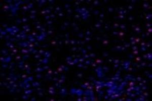 Immunofluorescent analysis of paraformaldehyde-fixed mouse kidney using,PNN (ABIN7075083) at dilution of 1: 800