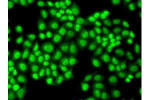 Immunofluorescence analysis of HeLa cells using GTF2F1 antibody (ABIN5971324). (GTF2F1 anticorps)