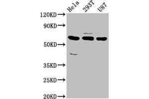 Western Blot Positive WB detected in: Hela whole cell lysate, 293T whole cell lysate, U87 whole cell lysate All lanes: NETO1 antibody at 3. (NETO1 anticorps  (AA 367-507))