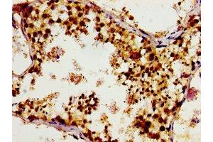 Immunohistochemistry of paraffin-embedded human testis tissue using ABIN7153569 at dilution of 1:100 (TUBGCP4 anticorps  (AA 203-309))