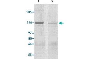 The tissue lysates derived from mouse heart (lane 1) or rat heart (lane 2) were immunoprobed by Corin polyclonal antibody  at 1 : 500. (Corin anticorps  (N-Term))