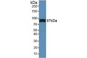 Figure. (Cadherin 5 anticorps  (AA 59-382))