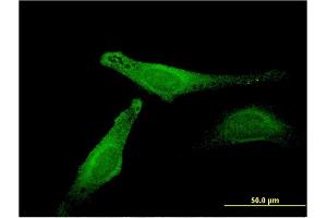 Immunofluorescence of monoclonal antibody to MB on HeLa cell.