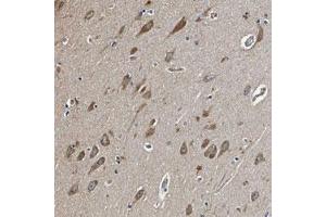 Immunohistochemical staining (Formalin-fixed paraffin-embedded sections) of human hippocampus with MIB1 polyclonal antibody  shows moderate cytoplasmic positivity in neuronal cells. (MIB1 anticorps)