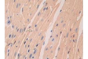 Detection of LAMa4 in Mouse Heart Tissue using Polyclonal Antibody to Laminin Alpha 4 (LAMa4)