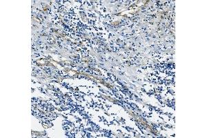 IHC analysis of CD31/PECAM1 using anti-CD31/PECAM1 antibody (ABIN7601076). (CD31 anticorps  (AA 28-382))