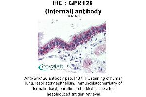 Image no. 2 for anti-G Protein-Coupled Receptor 126 (GPR126) (Internal Region) antibody (ABIN1734924) (G Protein-Coupled Receptor 126 anticorps  (Internal Region))