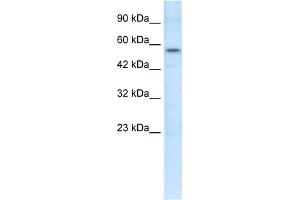 WB Suggested Anti-ETS1 Antibody Titration:  1. (ETS1 anticorps  (N-Term))