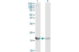 Western Blot analysis of RPS19 expression in transfected 293T cell line by RPS19 monoclonal antibody (M01A), clone 3C6. (RPS19 anticorps  (AA 1-145))