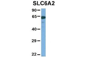 Host:  Rabbit  Target Name:  SLC6A2  Sample Type:  Human Adult Placenta  Antibody Dilution:  1.