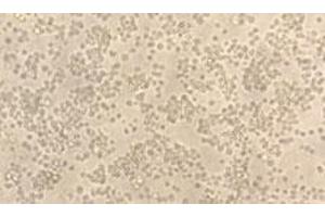 Platelet/endothelial Cell Adhesion Molecule (PECAM1) (AA 28-601) (Active) protein (His tag)