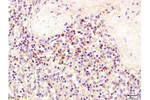 Formalin-fixed and paraffin embedded human spleen tissue labeled with Anti-SEMA4D/CD100 Polyclonal Antibody, Unconjugated (ABIN1387543) at 1:200 followed by conjugation to the secondary antibody and DAB staining (SEMA4D/CD100 anticorps  (AA 75-170))