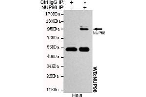 Immunoprecipitation analysis of Hela cell lysates using NUP98 mouse mAb. (NUP98 anticorps)