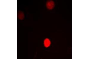 Immunofluorescent analysis of CTBP1 staining in HeLa cells. (CTBP1 anticorps  (C-Term))