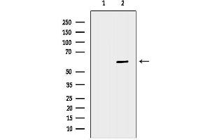 anti-Choline Dehydrogenase (CHDH) (Internal Region) antibody
