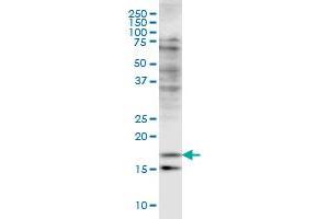 CFL2 monoclonal antibody (M03), clone 6G9 Western Blot analysis of CFL2 expression in HeLa . (Cofilin 2 anticorps  (AA 57-166))