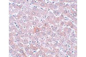 Immunohistochemical staining of rat liver tissue with RSRC1 polyclonal antibody  at 5 ug/mL dilution. (RSRC1 anticorps  (C-Term))