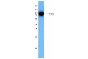 Western Blotting (WB) image for anti-Structure Specific Recognition Protein 1 (SSRP1) antibody (ABIN2666367) (SSRP1 anticorps)