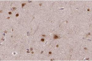 ABIN6272540 at 1/100 staining human brain tissue sections by IHC-P.