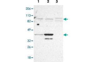 Western blot analysis of Lane 1: RT-4, Lane2: U-251MG sp, Lane 3: Human cell line A-431 with SLMAP polyclonal antibody . (SLMAP anticorps)