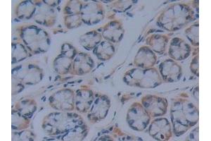 Detection of IkBd in Mouse Intestine Tissue using Polyclonal Antibody to Inhibitory Subunit Of NF Kappa B Delta (IkBd) (IkBd anticorps  (AA 58-304))