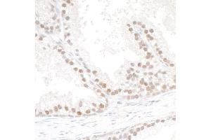 anti-SMC6 Structural Maintenance of Chromosomes 6-Like 1 (SMC6) (C-Term) antibody