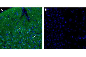 Free-floating frozen brain sections from a paraformaldehyde-perfused rat were incubated with Anti-Endothelin Receptor A (extracellular) Antibody (ABIN7581867, 1:300), followed by goat anti-rabbit secondary antibody conjugated to Alexa Fluor® 488 (green).