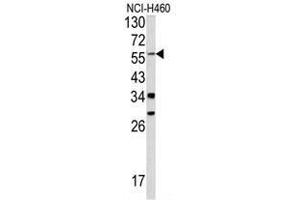 Western blot analysis of YAP1 antibody (C-term) in NCI-H460 cell line lysates (35ug/lane). (YAP1 anticorps  (C-Term))