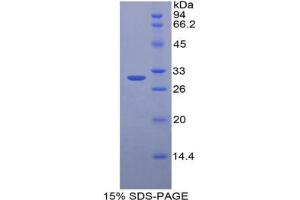 SDS-PAGE analysis of Mouse HGD Protein. (HGD Protéine)