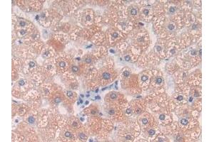 Detection of C9 in Human Liver Tissue using Polyclonal Antibody to Complement Component 9 (C9) (C9 anticorps  (AA 22-265))