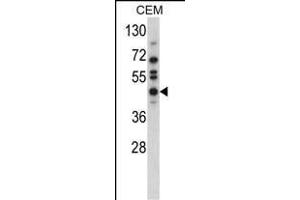 Western blot analysis of USP12 Antibody (N-term) (ABIN388898 and ABIN2839184) in CEM cell line lysates (35 μg/lane). (USP12 anticorps  (N-Term))