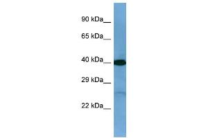 Western Blotting (WB) image for anti-Twinfilin, Actin-Binding Protein, Homolog 2 (Drosophila) (TWF2) (C-Term) antibody (ABIN2784884) (TWF2 anticorps  (C-Term))