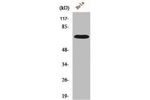 Western Blot analysis of HuvEc cells using IL-17RC Polyclonal Antibody