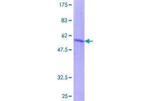 Image no. 1 for Ankyrin Repeat and SOCS Box Containing 7 (ASB7) protein (GST tag) (ABIN1345817)