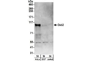 Western Blotting (WB) image for anti-Disabled Homolog 2, Mitogen-Responsive phosphoprotein (Drosophila) (DAB2) (AA 275-325) antibody (ABIN7449708)