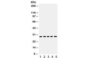 Western blot testing of 1) rat kidney, 2) rat lung, 3) rat heart, 4) rat PC-12 and 5) mouse HEPA lysate with Aquaporin 1 antibody. (Aquaporin 1 anticorps)