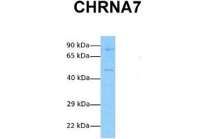 Host:  Rabbit  Target Name:  CHRNA7  Sample Tissue:  Human Jurkat  Antibody Dilution:  1. (CHRNA7 anticorps  (N-Term))
