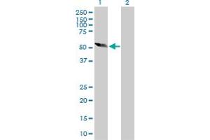Western Blot analysis of DPH2 expression in transfected 293T cell line by DPH2 MaxPab polyclonal antibody. (DPH2 anticorps  (AA 1-489))